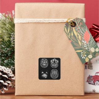 Brain MRI scan Square Sticker