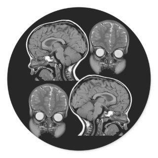 BRAINS! (MRI) CLASSIC ROUND STICKER