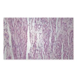 Cells of human uterus tissue with inoffensive tumo rectangular sticker