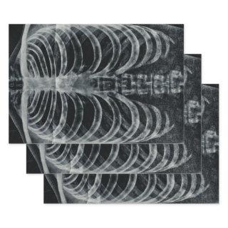 Skeleton Xray Rib Cage Vintage Black White Gothic  Sheets