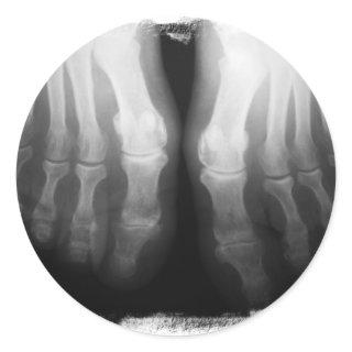 X-Ray Feet Human Skeleton Bones Black & White Classic Round Sticker