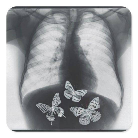 X-ray of butterflies in the stomach square sticker